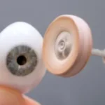 Prosthetic Eye