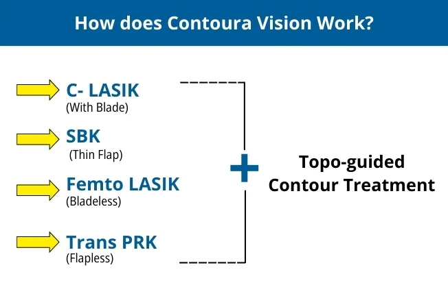 contoura-vision-lasik