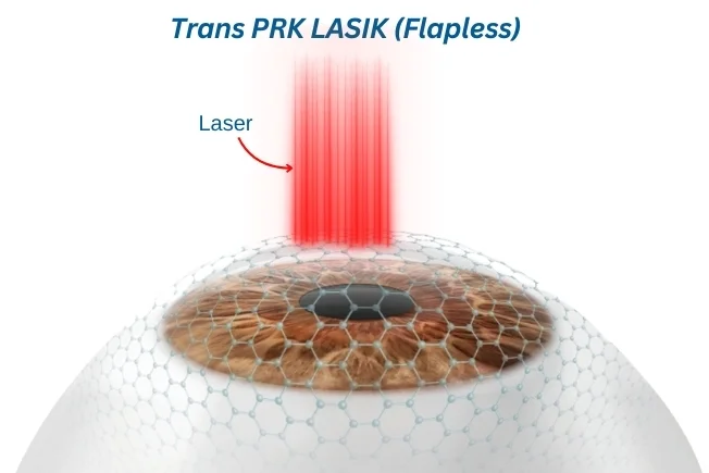 transprk